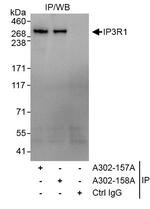 IP3R1 Antibody in Immunoprecipitation (IP)