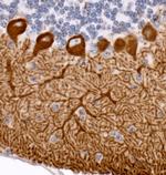 IP3R1 Antibody in Immunohistochemistry (Paraffin) (IHC (P))