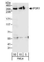 IP3R1 Antibody in Western Blot (WB)