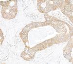 IP3R3 Antibody in Immunohistochemistry (Paraffin) (IHC (P))