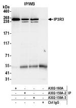 IP3R3 Antibody in Immunoprecipitation (IP)