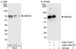 MEKK2 Antibody in Western Blot (WB)