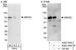 MEKK2 Antibody in Western Blot (WB)