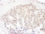 Cul5 Antibody in Immunohistochemistry (Paraffin) (IHC (P))