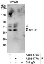 SPHK1 Antibody in Immunoprecipitation (IP)