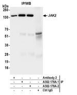 JAK2 Antibody in Immunoprecipitation (IP)