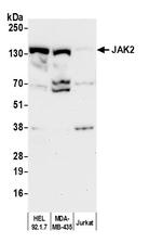 JAK2 Antibody in Western Blot (WB)