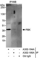 PBK Antibody in Immunoprecipitation (IP)