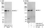 MKL1 Antibody in Western Blot (WB)