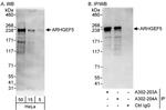 ARHGEF5 Antibody in Western Blot (WB)