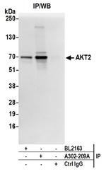 AKT2 Antibody in Immunoprecipitation (IP)