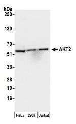 AKT2 Antibody in Western Blot (WB)