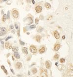 HBO Antibody in Immunohistochemistry (Paraffin) (IHC (P))