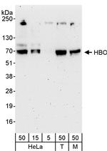 HBO Antibody in Western Blot (WB)