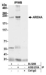 ARID4A Antibody in Immunoprecipitation (IP)