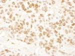 ARID4B Antibody in Immunohistochemistry (Paraffin) (IHC (P))