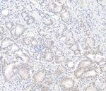 BAP1 Antibody in Immunohistochemistry (Paraffin) (IHC (P))