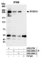 BTBD12 Antibody in Immunoprecipitation (IP)