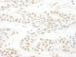 BTBD12 Antibody in Immunohistochemistry (Paraffin) (IHC (P))