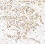 CAP-H2 Antibody in Immunohistochemistry (Paraffin) (IHC (P))