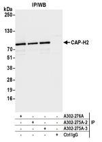 CAP-H2 Antibody in Immunoprecipitation (IP)