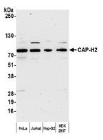 CAP-H2 Antibody in Western Blot (WB)