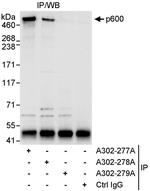 p600 Antibody in Immunoprecipitation (IP)