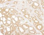 p600 Antibody in Immunohistochemistry (Paraffin) (IHC (P))