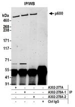 p600 Antibody in Immunoprecipitation (IP)