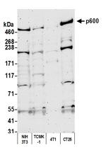 p600 Antibody in Western Blot (WB)