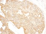 p600 Antibody in Immunohistochemistry (Paraffin) (IHC (P))