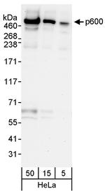 p600 Antibody in Western Blot (WB)