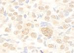 FUSIP1 Antibody in Immunohistochemistry (Paraffin) (IHC (P))