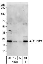 FUSIP1 Antibody in Western Blot (WB)