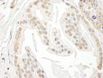 POLR3D Antibody in Immunohistochemistry (Paraffin) (IHC (P))