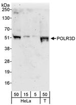 POLR3D Antibody in Western Blot (WB)