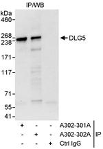 DLG5 Antibody in Immunoprecipitation (IP)