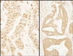 BTF3 Antibody in Immunohistochemistry (Paraffin) (IHC (P))