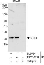 BTF3 Antibody in Immunoprecipitation (IP)