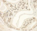 PHF23 Antibody in Immunohistochemistry (Paraffin) (IHC (P))