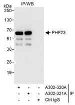 PHF23 Antibody in Immunoprecipitation (IP)