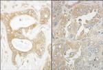 EB1 Antibody in Immunohistochemistry (Paraffin) (IHC (P))