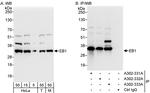 EB1 Antibody in Western Blot (WB)