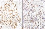 HMGN1 Antibody in Immunohistochemistry (Paraffin) (IHC (P))