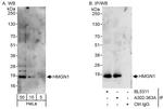 HMGN1 Antibody in Western Blot (WB)