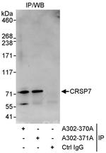 CRSP7 Antibody in Immunoprecipitation (IP)