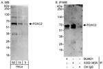 FOXC2 Antibody in Western Blot (WB)