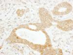 Tankyrase 1 Antibody in Immunohistochemistry (Paraffin) (IHC (P))