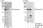 Tankyrase 1 Antibody in Western Blot (WB)