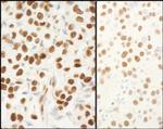 NPM1 Antibody in Immunohistochemistry (Paraffin) (IHC (P))